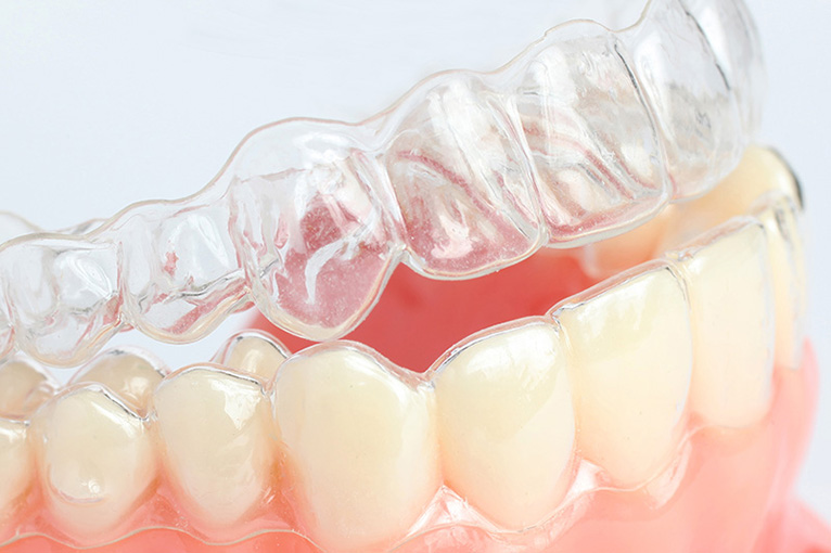 blanqueamiento dental leganes